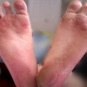 Can seniors run barefoot? (Redux.)